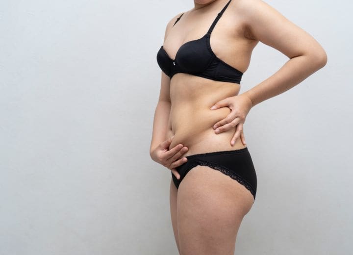 HR Plastic Surgery - Love handles / Excess abdominal fat
